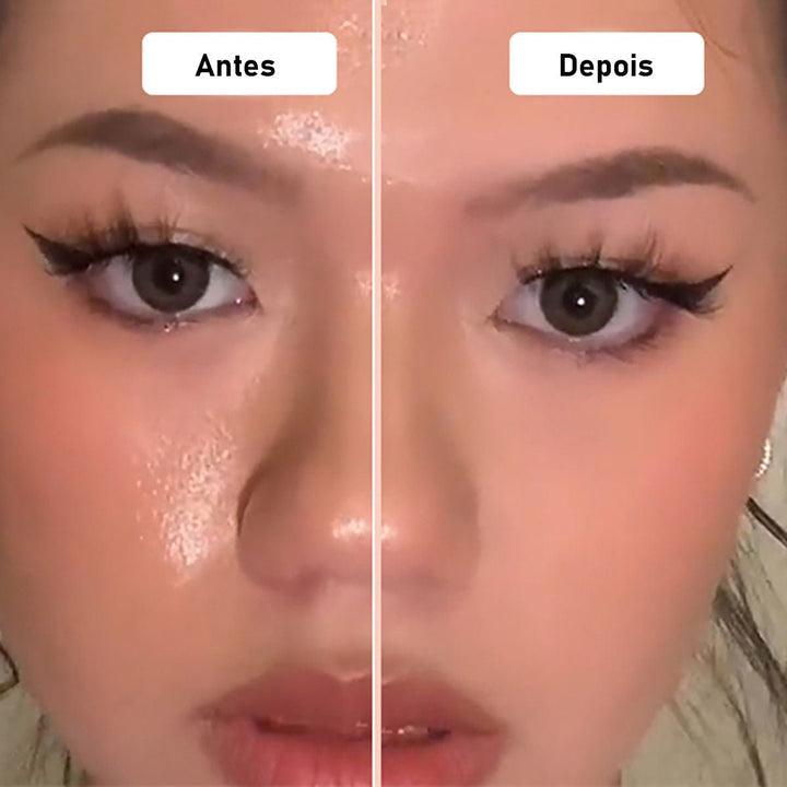 Skin Fine™ Antioleosidade